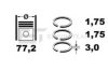 HYUNDAI 230402A960 Piston Ring Kit